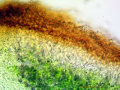 Placidium squamulosum