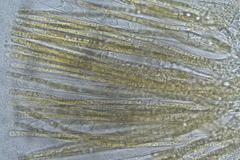 Cheilymenia coprinaria