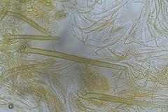 Cheilymenia coprinaria