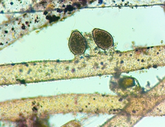 Vaucheria bursata