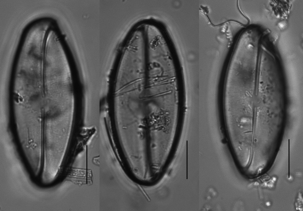Eucocconeis