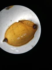 Erpobdellidae