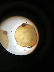Erpobdellidae