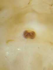 Thwaitesia margaritifera