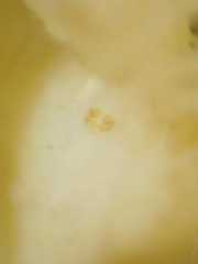 Meotipa spiniventris