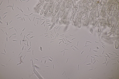 Cistella grevillei