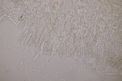 Cistella grevillei