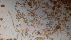 Gymnosporangium tremelloides