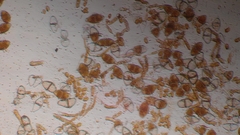 Gymnosporangium tremelloides