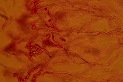 Gloeomucro dependens