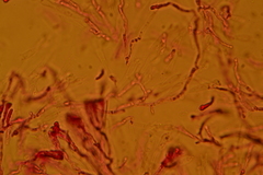 Gloeomucro dependens