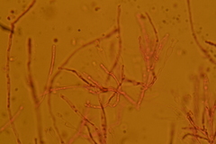 Gloeomucro dependens