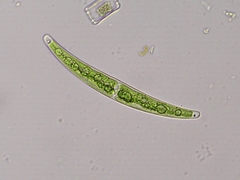 Closterium tumidum