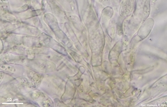 Dermateaceae