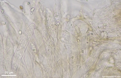 Dermateaceae