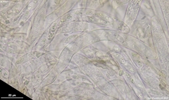 Dermateaceae