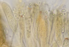 Dermateaceae
