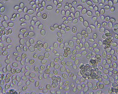 Saccharomyces cerevisiae
