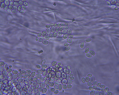 Saccharomyces cerevisiae