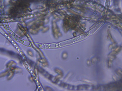 Eurotiomycetes