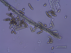 Eurotiomycetes
