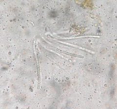 Trichoderma americanum
