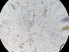 Trichoderma americanum