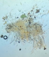 Octospora excipulata