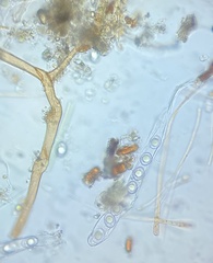 Octospora excipulata