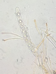 Octospora excipulata