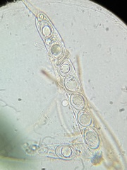 Octospora excipulata