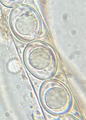 Octospora excipulata