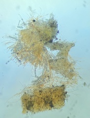 Octospora excipulata