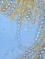 Octospora excipulata