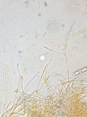 Octospora excipulata