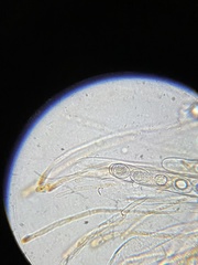 Octospora excipulata