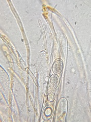 Octospora excipulata