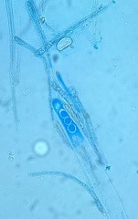 Octospora excipulata