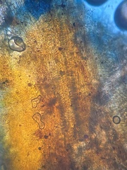 Octospora excipulata