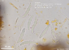 Lophiostoma