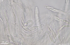 Lophiostoma