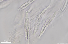 Lophiostoma