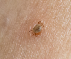 Ixodidae