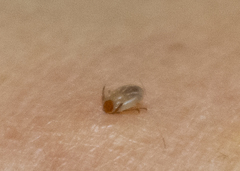 Ixodidae
