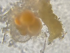 Globigerina