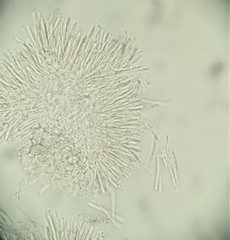 Pyrenopeziza protrusa
