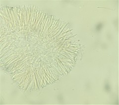 Pyrenopeziza protrusa