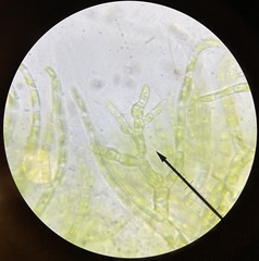 Chaetophoropsis elegans