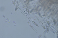Sclerotinia