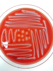 Staphylococcus aureus